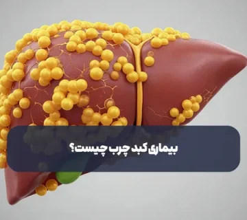 بیماری کبد چرب چیست