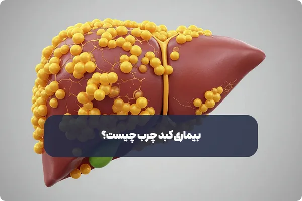 بیماری کبد چرب چیست