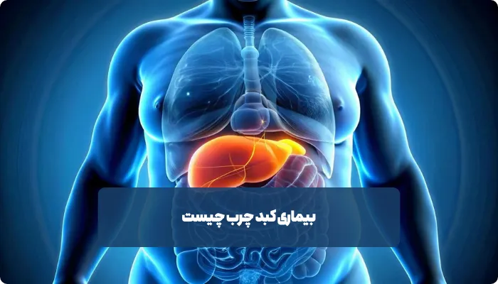 تشخیص کبد چرب چگونه انجام می‌شود