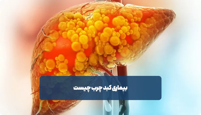 علائم کبد چرب چیست
