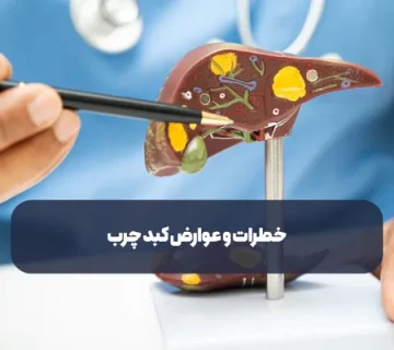 خطرات و عوارض کبد چرب