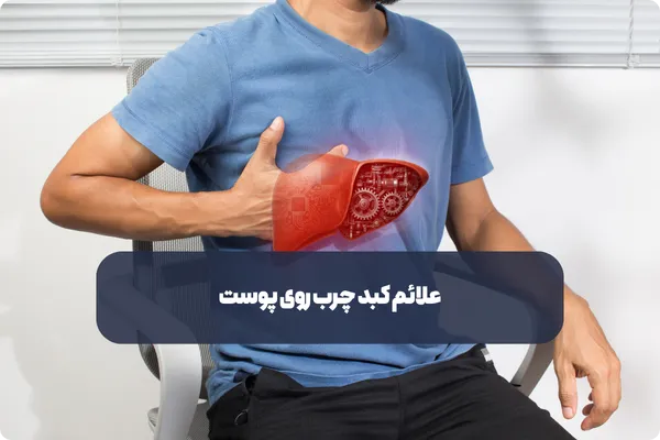 علائم کبد چرب روی پوست