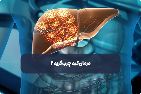 درمان کبد چرب گرید ۲